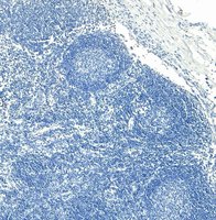 ADAM8 Antibody