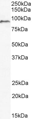 ADAM8 Antibody