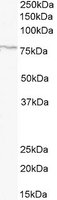 ADAM8 Antibody