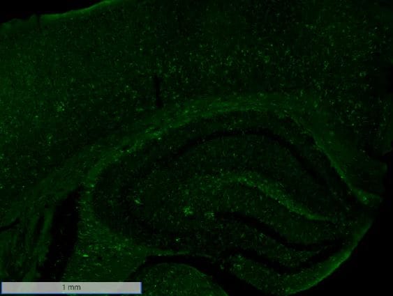 AIF-1/Iba1 Staining in Frozen Mouse Brain Tissue