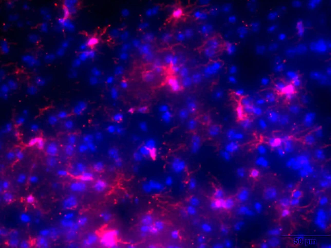Staining of Frozen LPS Injected Mouse Brain Tissue