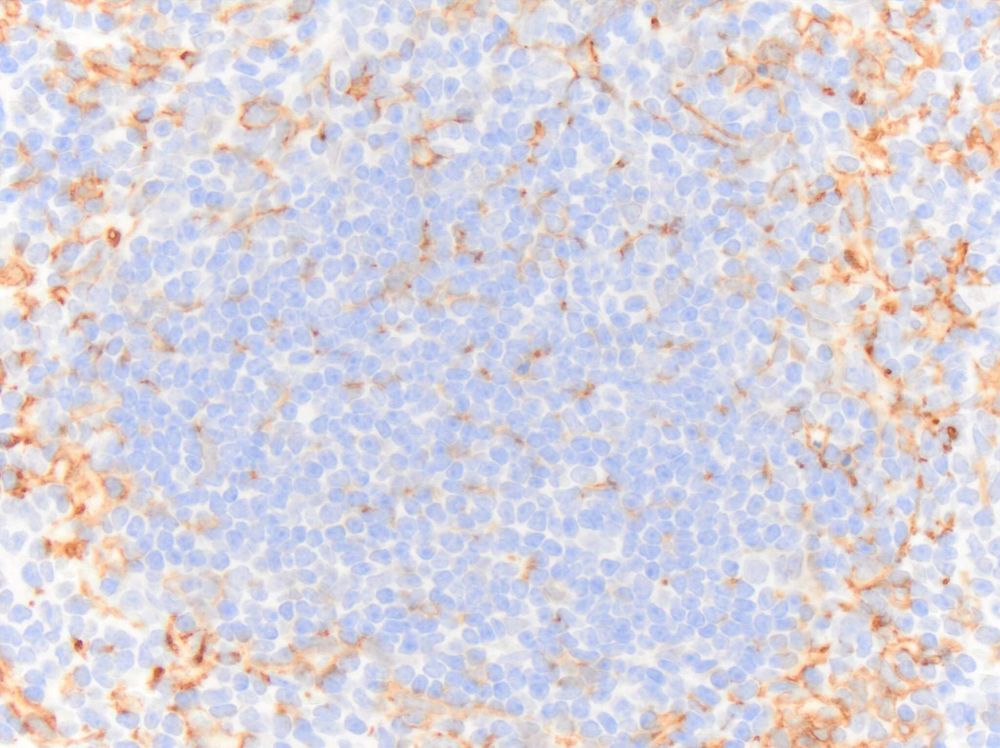 AIF-1/Iba1 Antibody