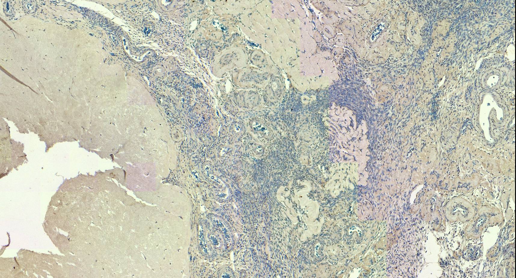 FOXL2 Antibody