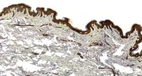KDM2B Antibody