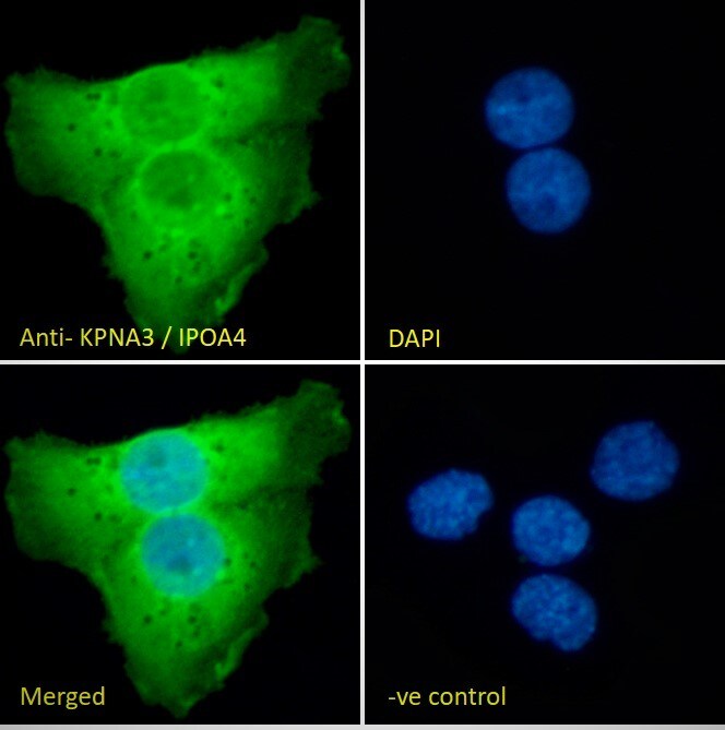 KPNA3 Antibody