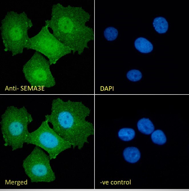 Semaphorin 3E Antibody
