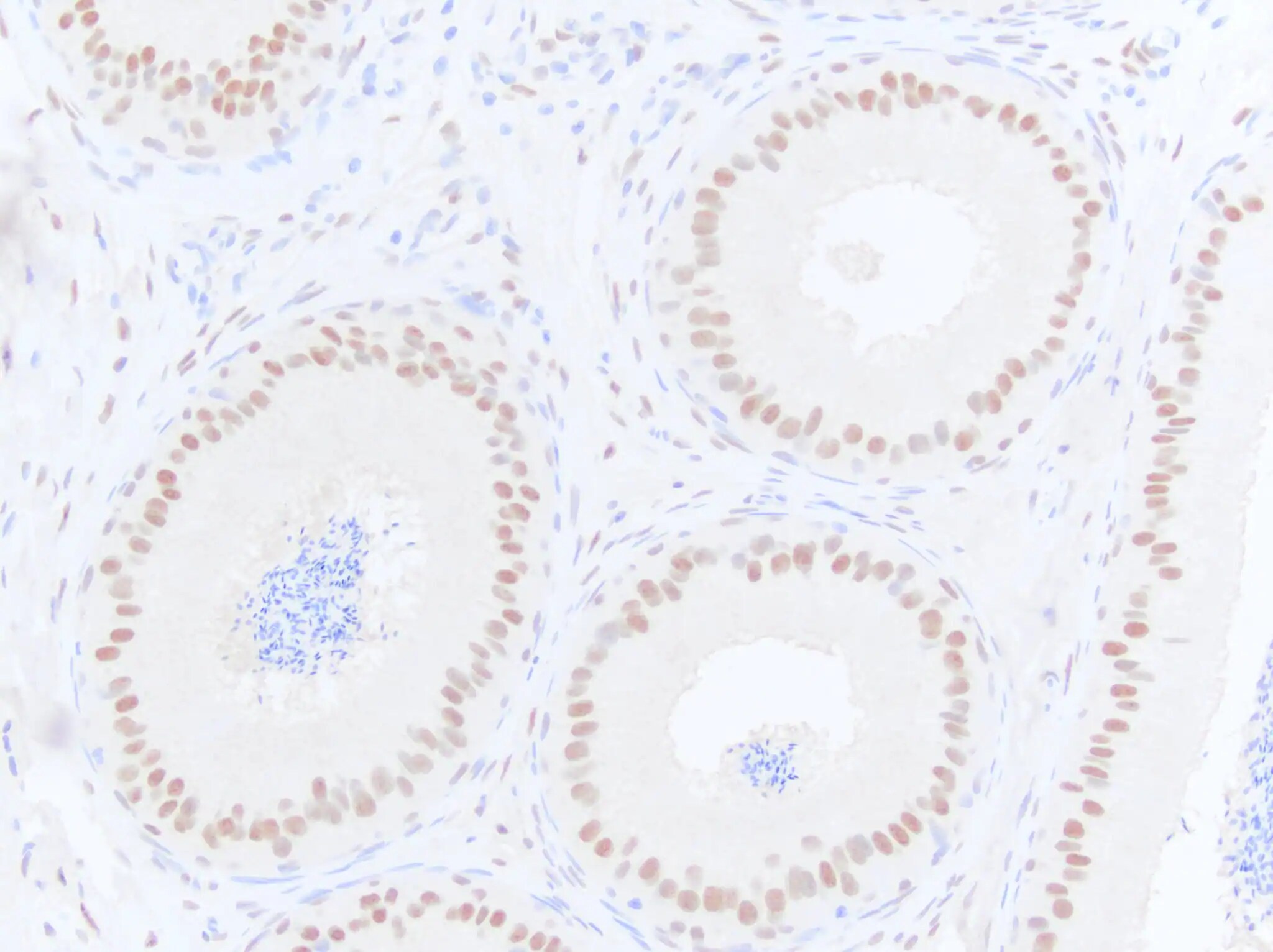 Androgen R/NR3C4 Antibody