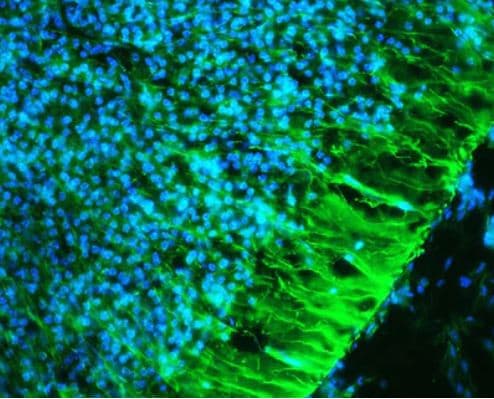 Nestin Antibody Immunohistochemistry: Nestin Antibody [NB100-1604]