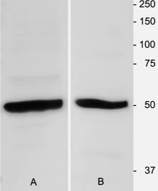 beta-III Tubulin Antibody Western Blot: beta-III Tubulin Antibody [NB100-1612]