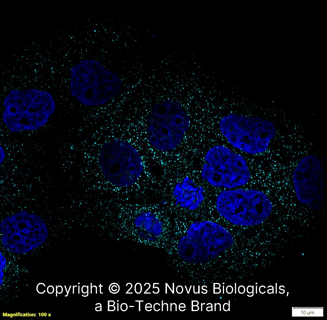 Desmoglein-3 Antibody (5G11) - BSA Free