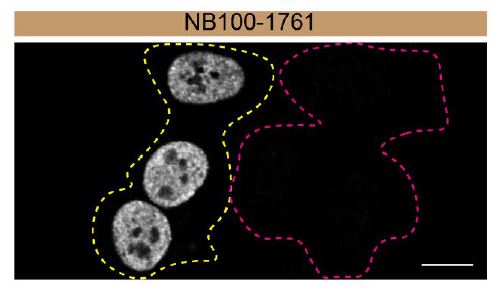 Matrin 3 Antibody