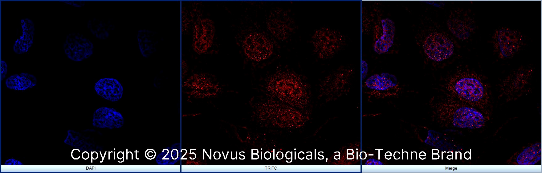 FANCD2 Antibody - BSA Free