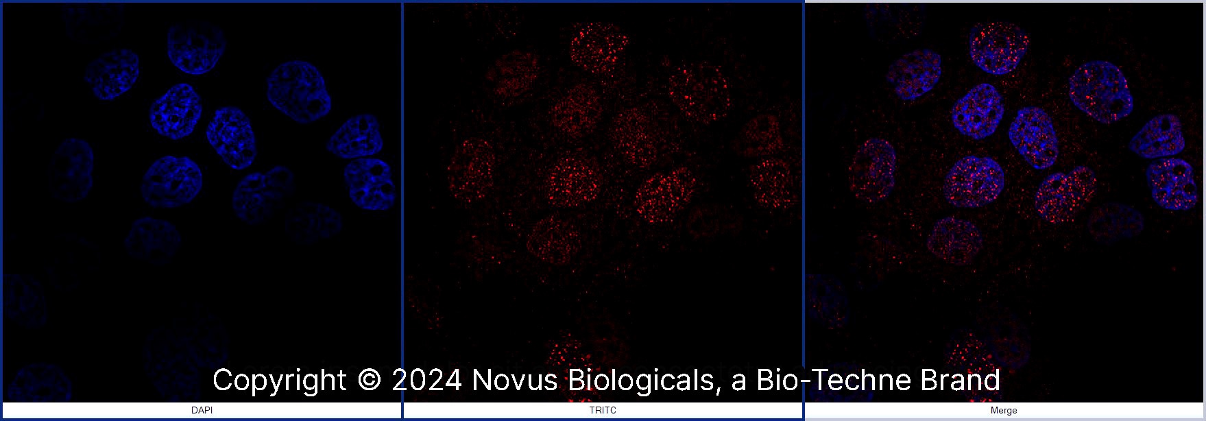 FANCD2 Antibody - BSA Free
