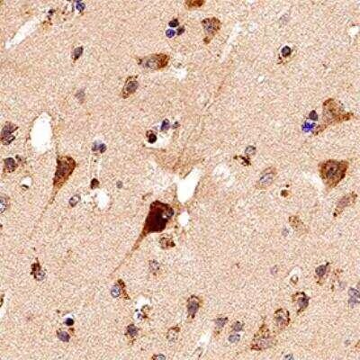 PDIA2 Antibody