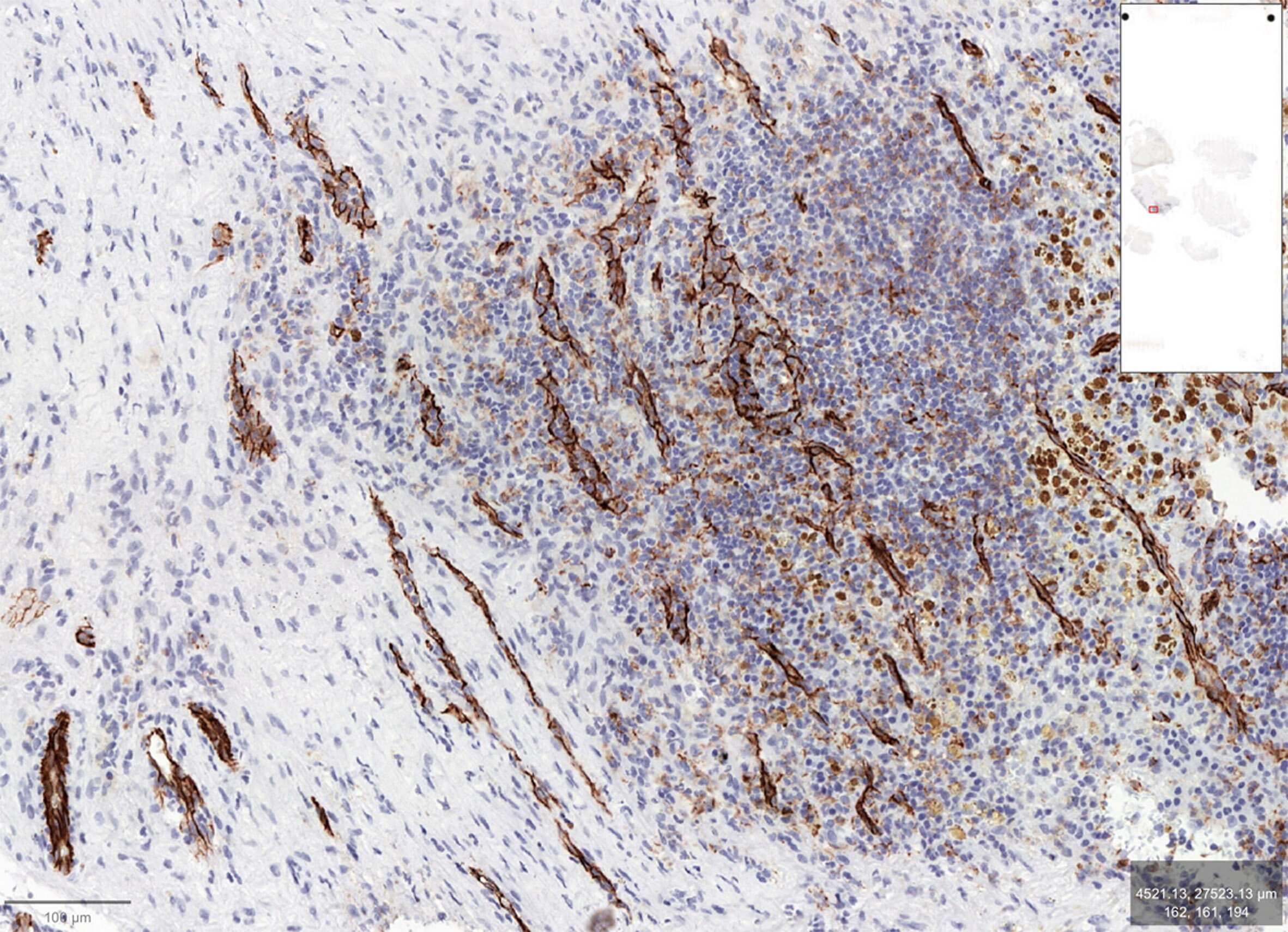 CD31/PECAM-1 Antibody