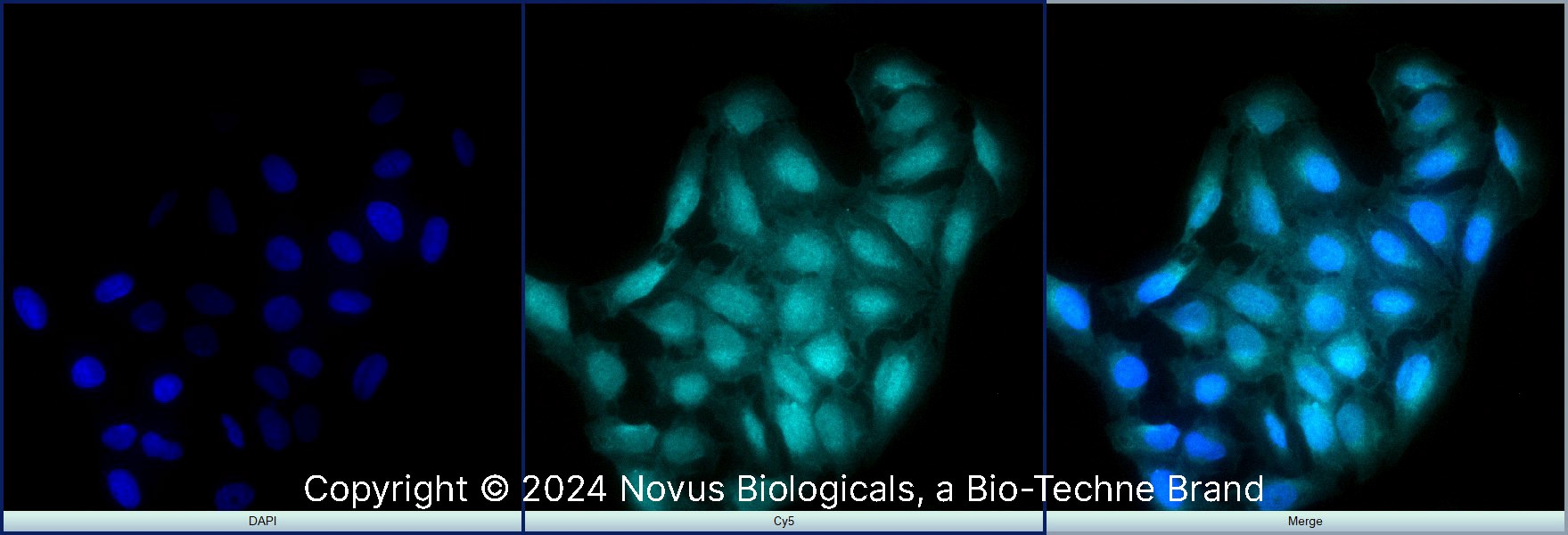 BMAL1 Antibody