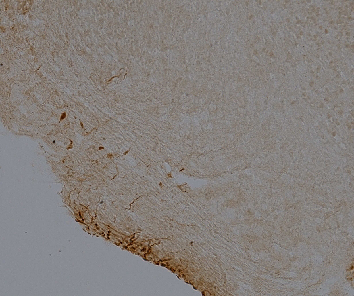 BMAL1 Antibody