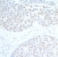 Spt6 Antibody
