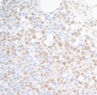 Spt6 Antibody