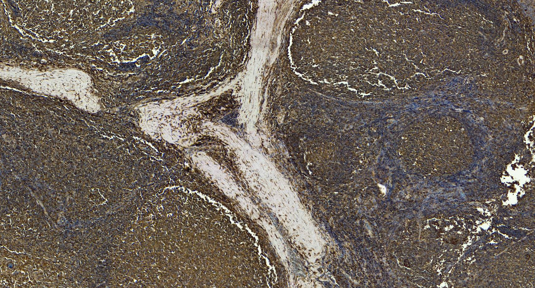 CD14 Antibody
