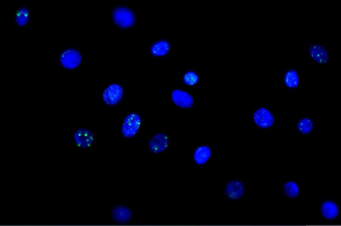 Cells Stained with 53BP1 Antibody in Immunocytochemistry/Immunofluorescence