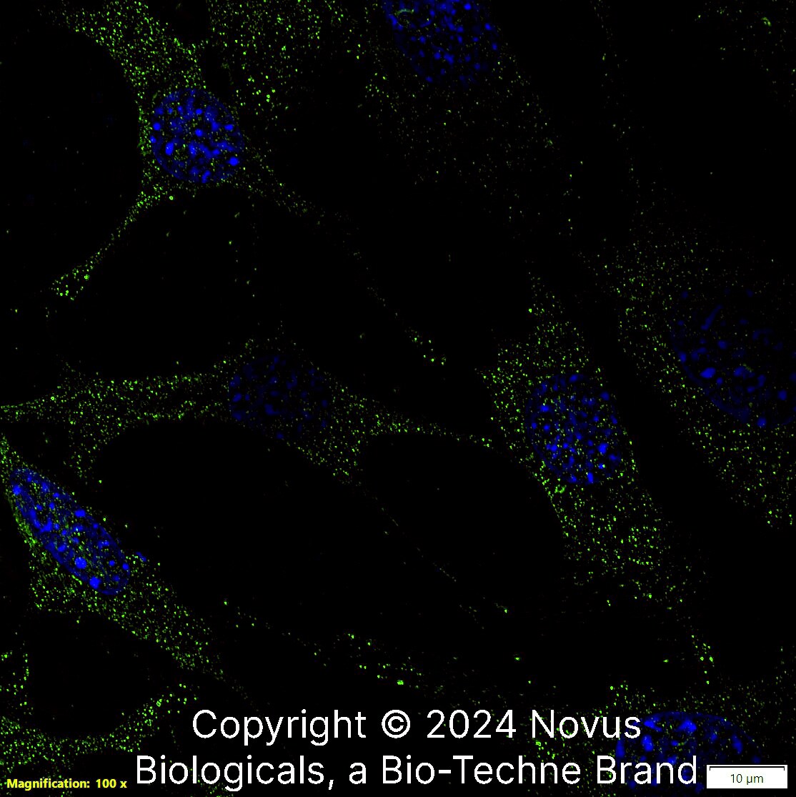 SLC31A1/CTR1 Antibody
