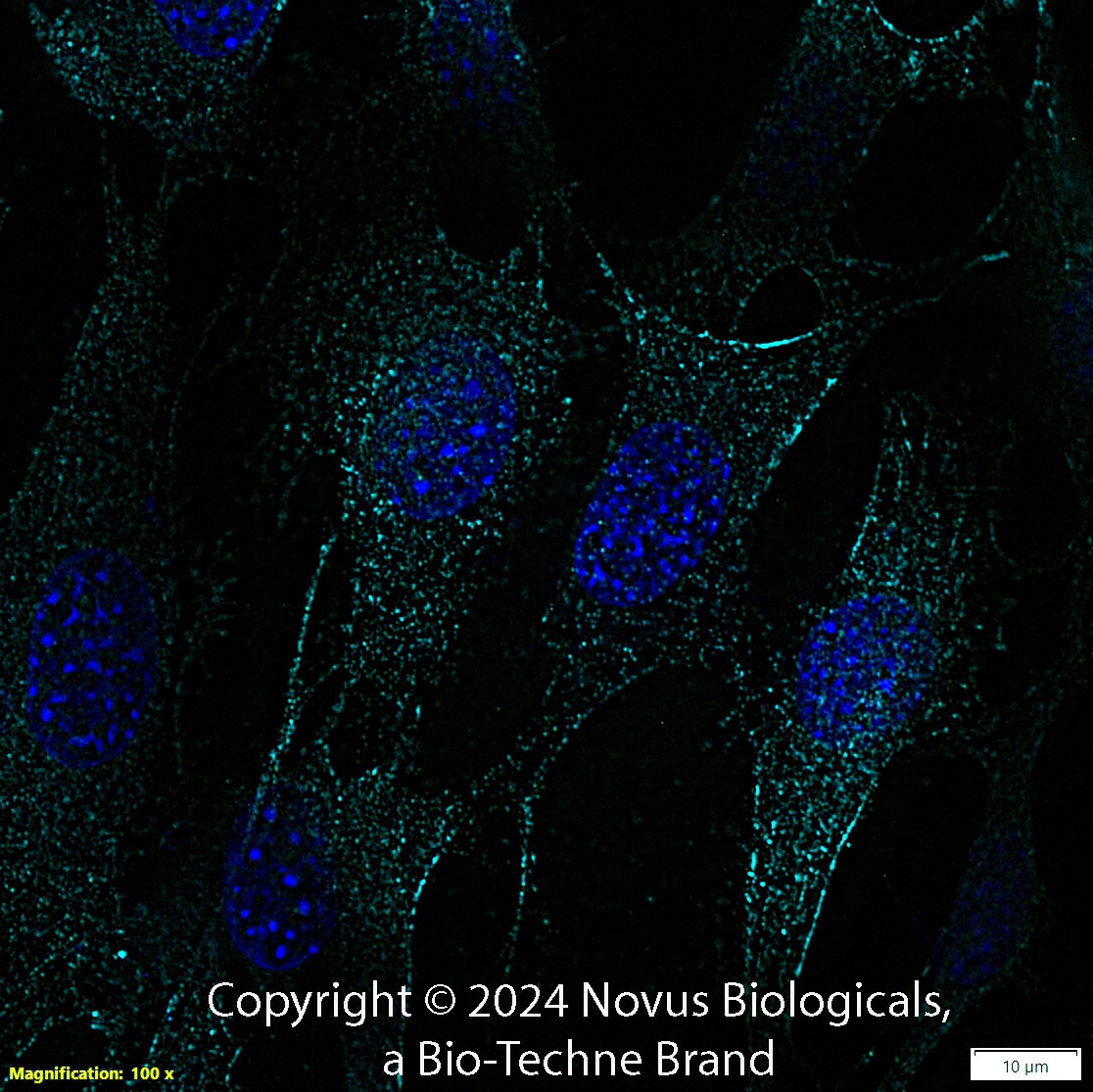 SLC31A1/CTR1 Antibody