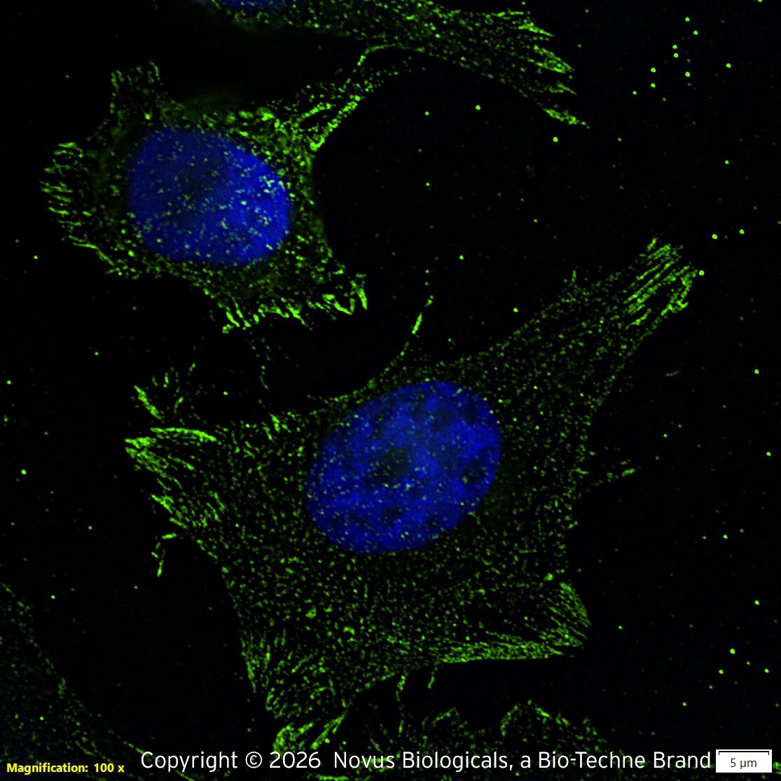 14-3-3 gamma [ac Val2] Antibody (KC21) - BSA Free Immunocytochemistry/Immunofluorescence: 14-3-3 gamma [ac Val2] Antibody (KC21)