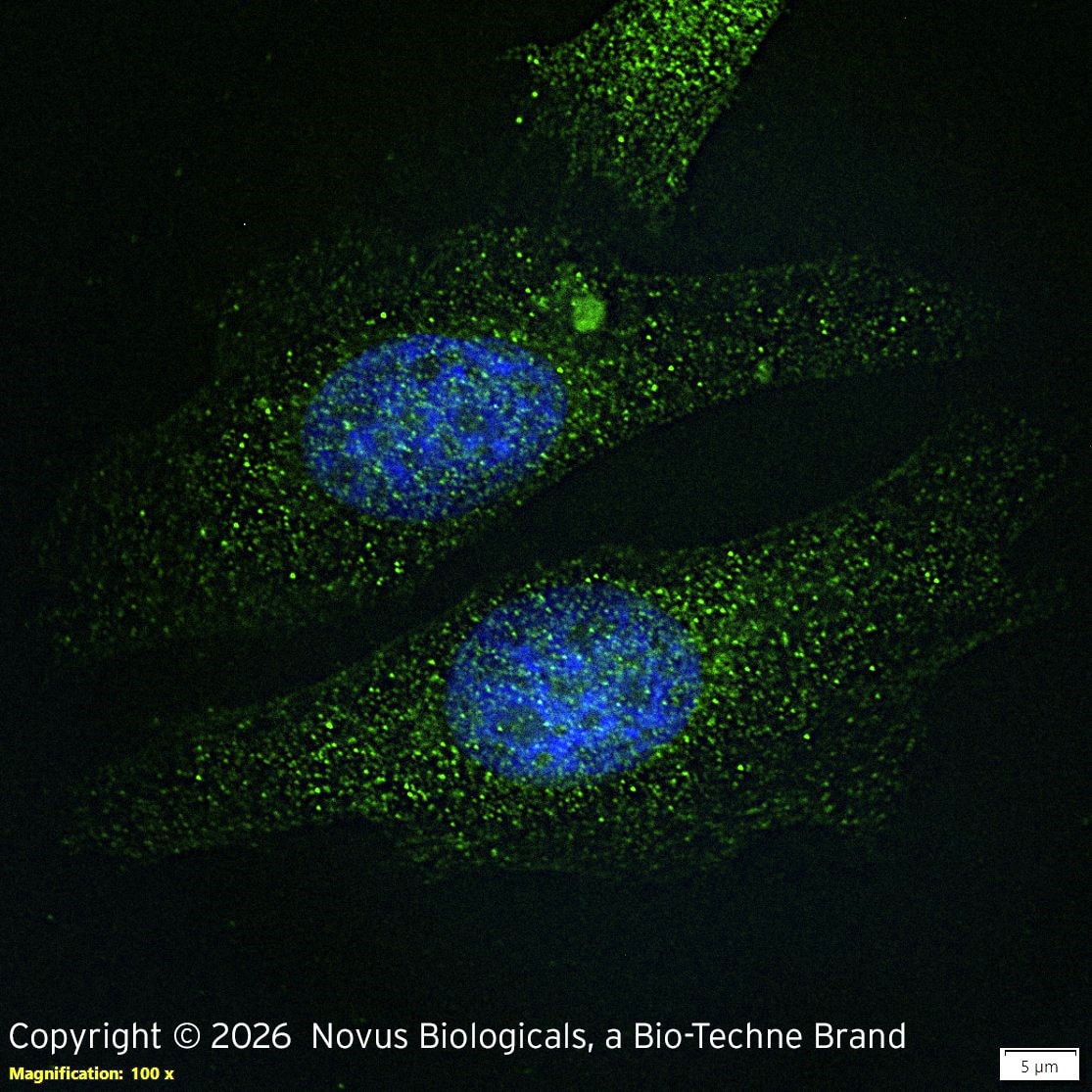 PINK1 Antibody - BSA Free Immunocytochemistry/ Immunofluorescence: PINK1 Antibody [NB100-493]