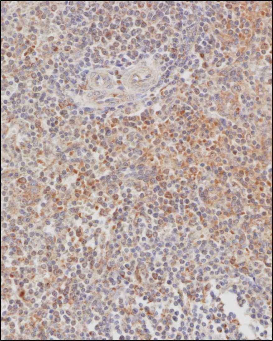 CCR1 Antibody - BSA Free