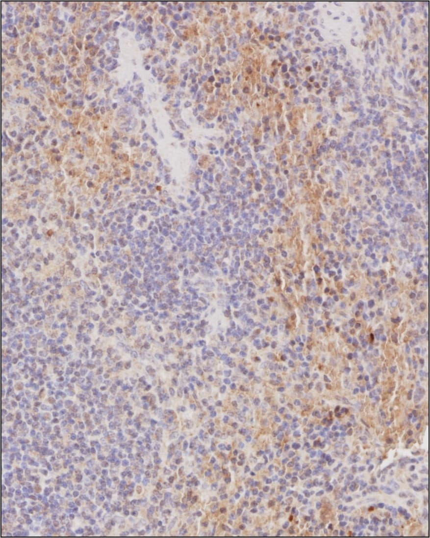 CCR1 Antibody - BSA Free
