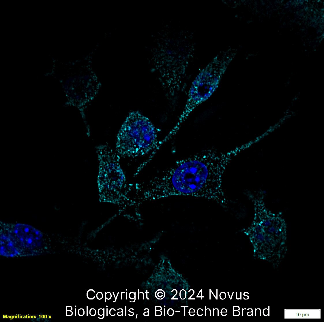 RANK/TNFRSF11A Antibody (9A725) - BSA Free