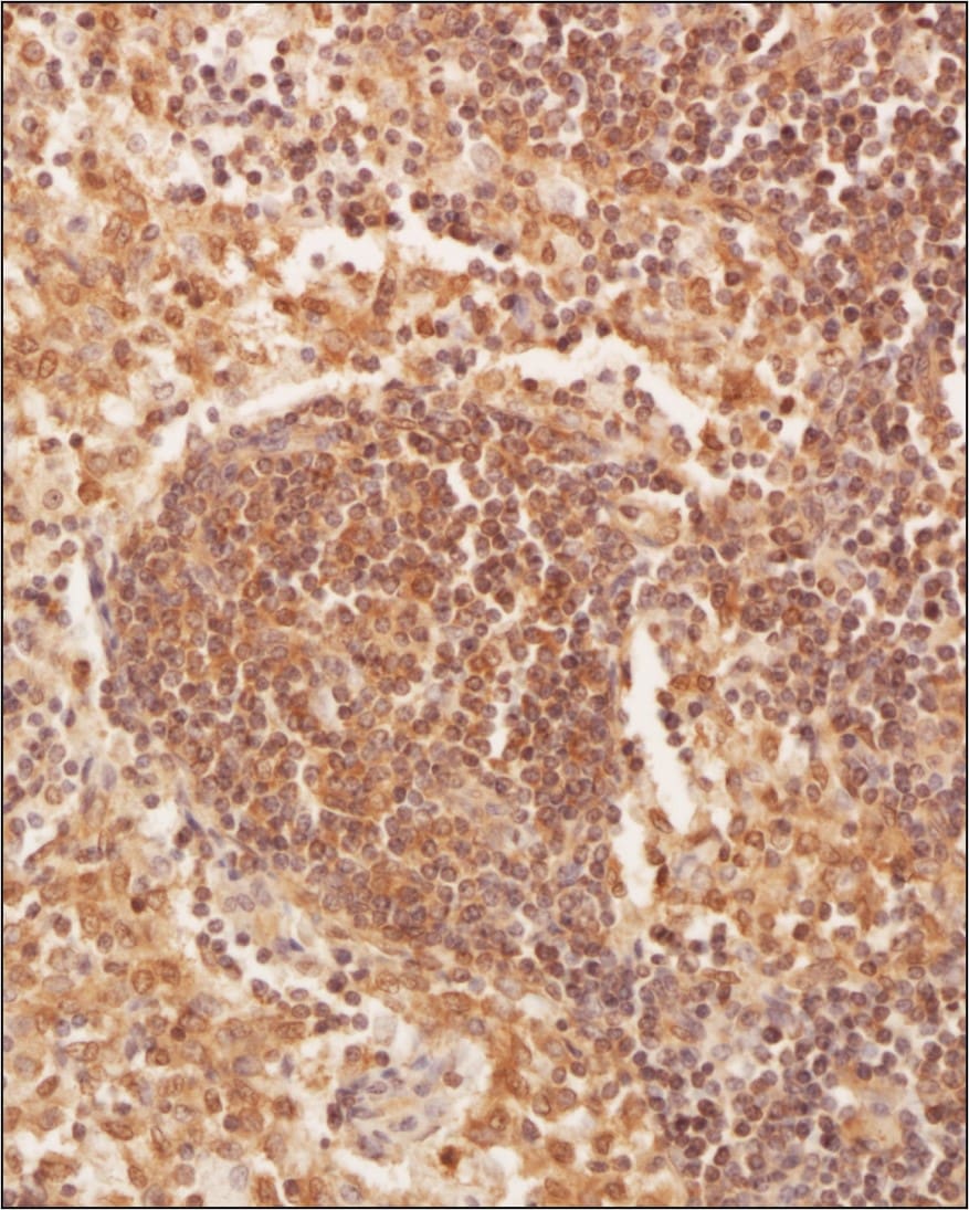 NFkB p105/p50 Antibody (2J10D7) - BSA Free Immunohistochemistry-Paraffin: NFkB p105/p50 Antibody (2J10D7) - BSA Free [NB100-56583]