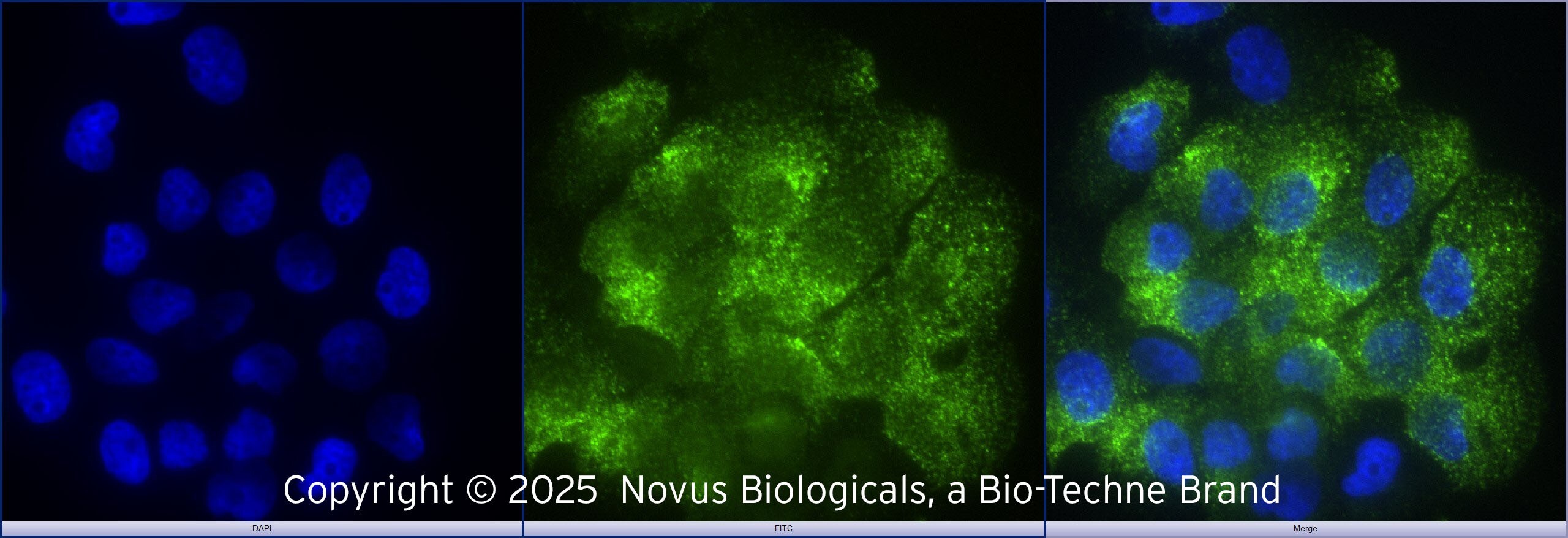 TLR2 Antibody - BSA Free TLR2 Antibody - BSA Free Immunocytochemistry / Immunofluorescence: TLR2 Antibody [NB100-56720]