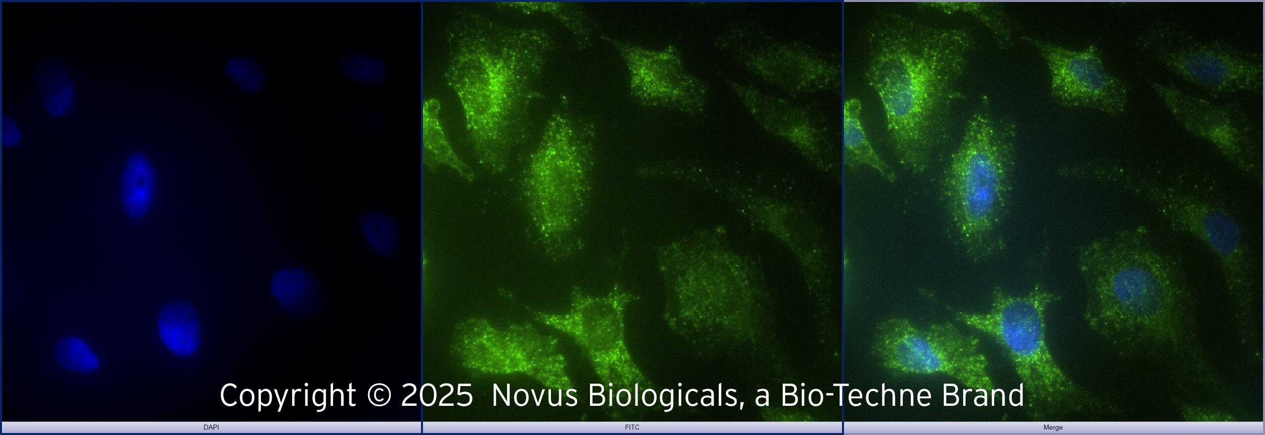 TLR2 Antibody - BSA Free Immunocytochemistry / Immunofluorescence: TLR2 Antibody [NB100-56720]