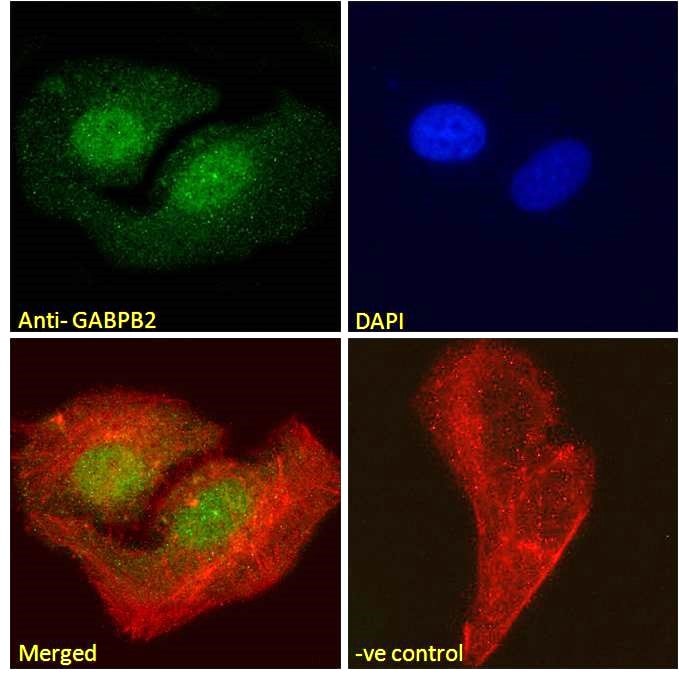 GABPB1 Antibody