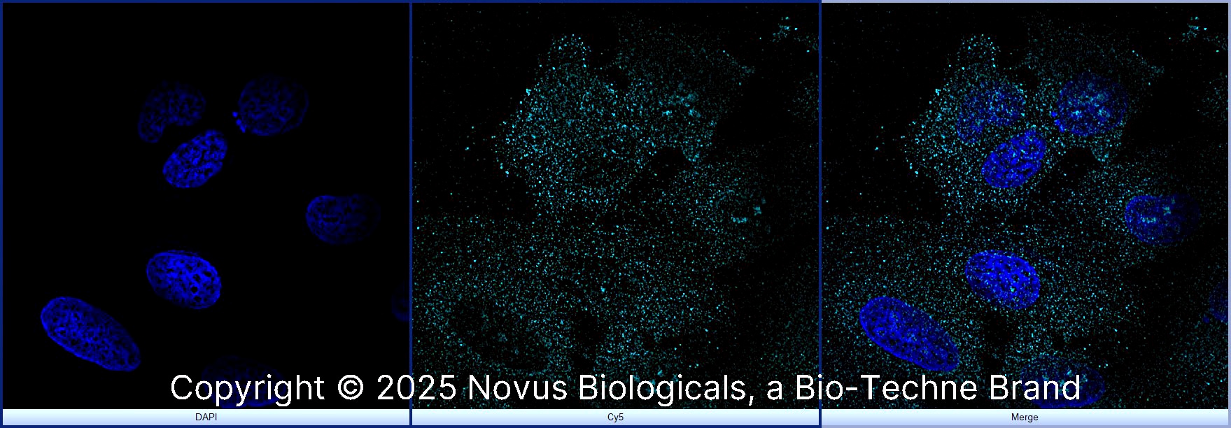 rRNA Antibody (Y10b) - BSA Free