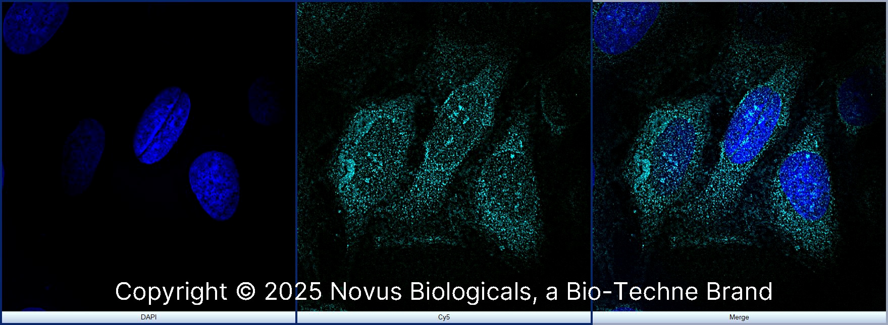 rRNA Antibody (Y10b) - BSA Free