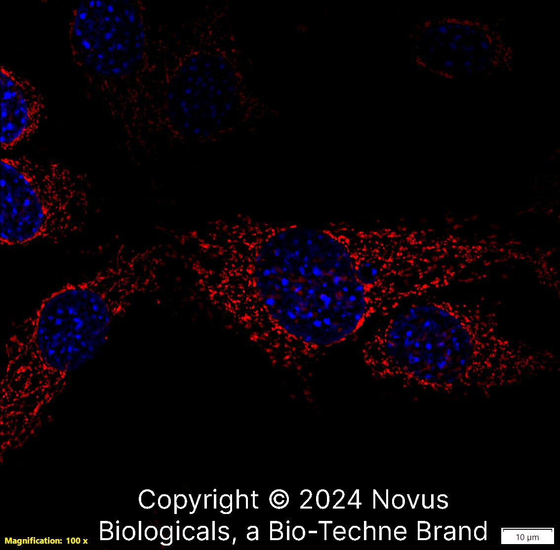 rRNA Antibody (Y10b) - BSA Free