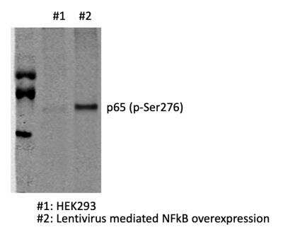 RelA/NFkB p65 [p Ser276] Antibody