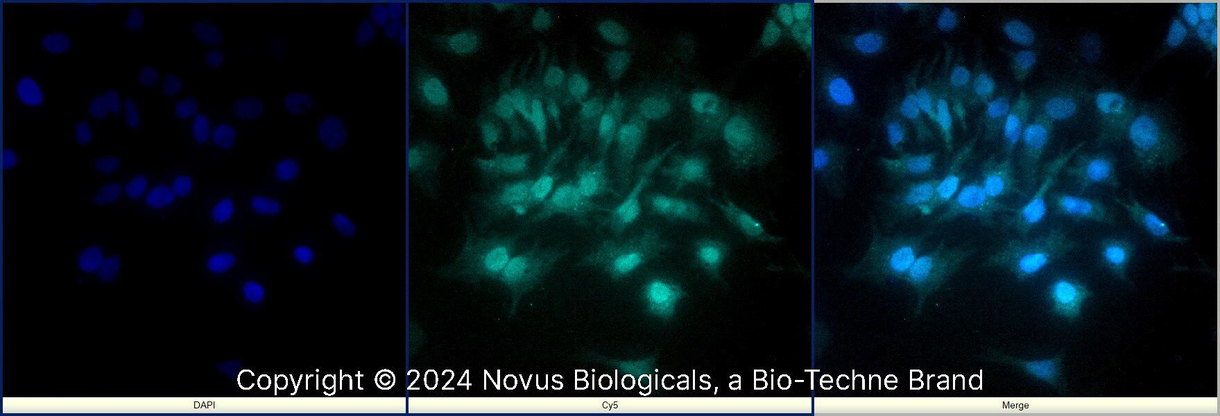 EGR2 Antibody - BSA Free