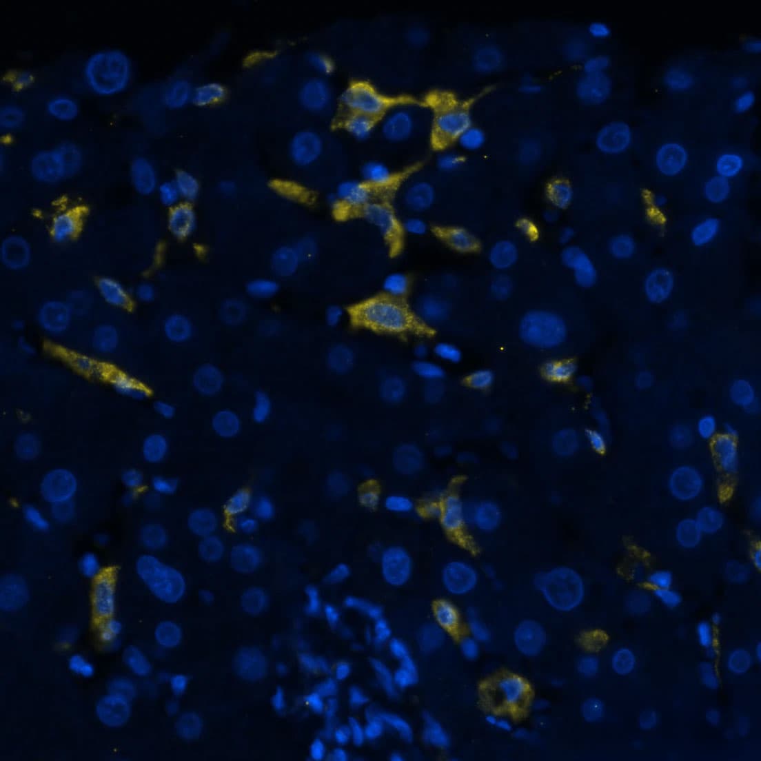 CD163 Antibody (EDHu-1)