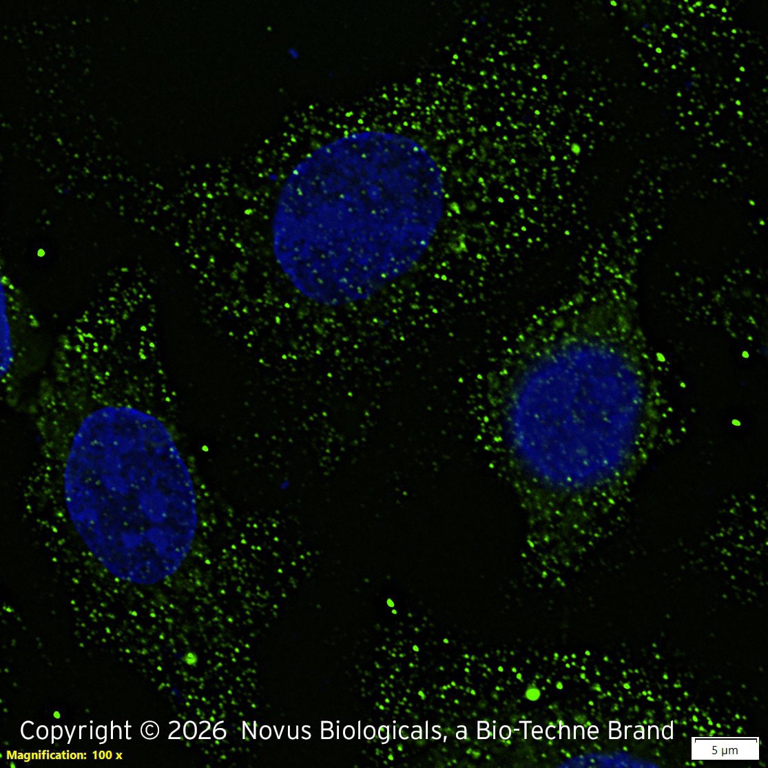 Perilipin Antibody - BSA Free Immunocytochemistry/ Immunofluorescence: Perilipin Antibody [NB110-40760]