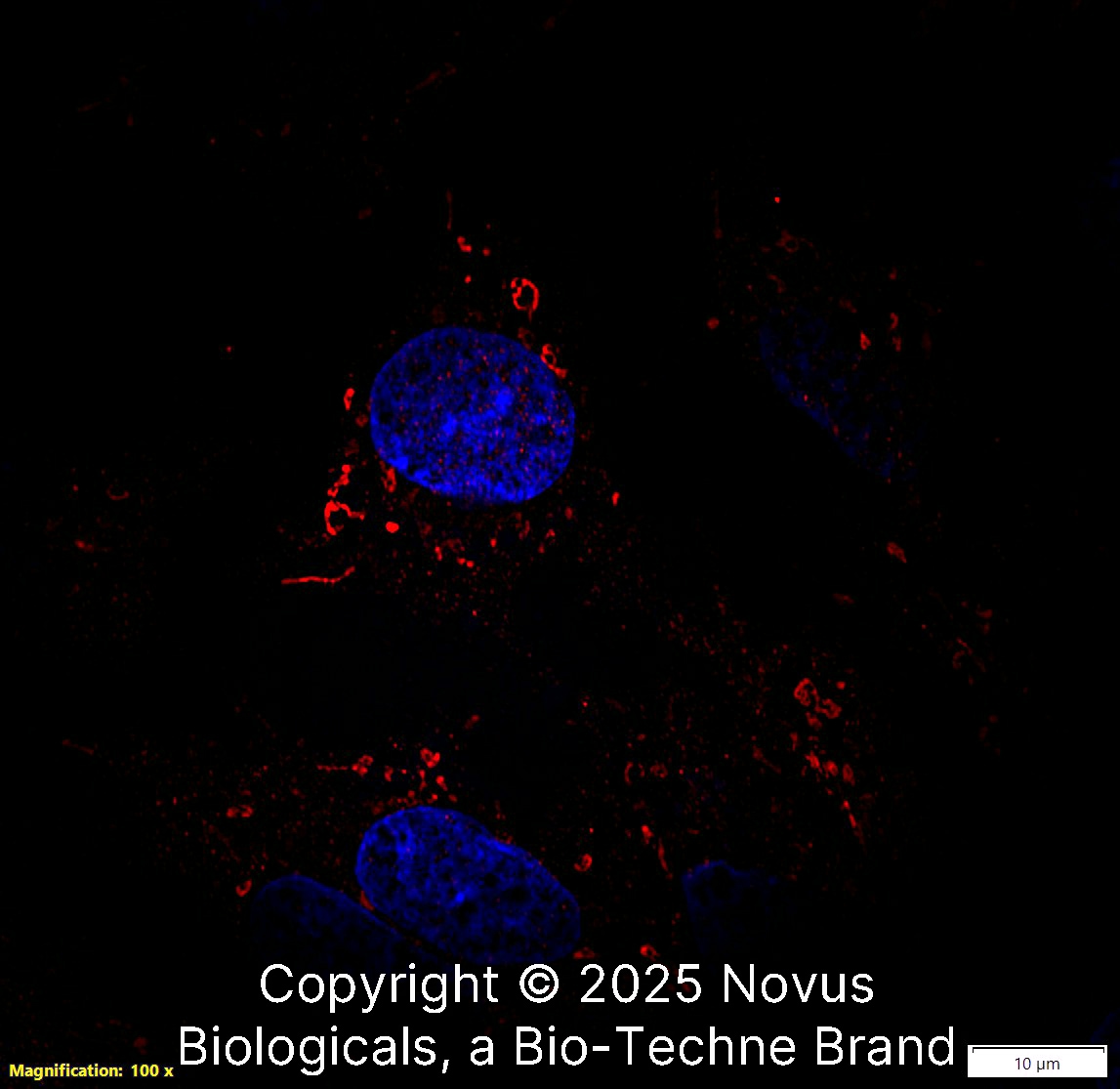 Perilipin-2/ADFP Antibody - BSA Free