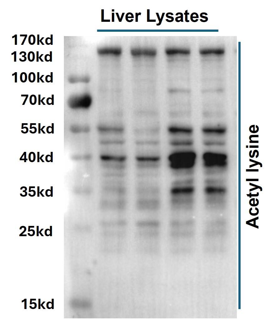 Acetyl-Lysine Antibody (7F8)