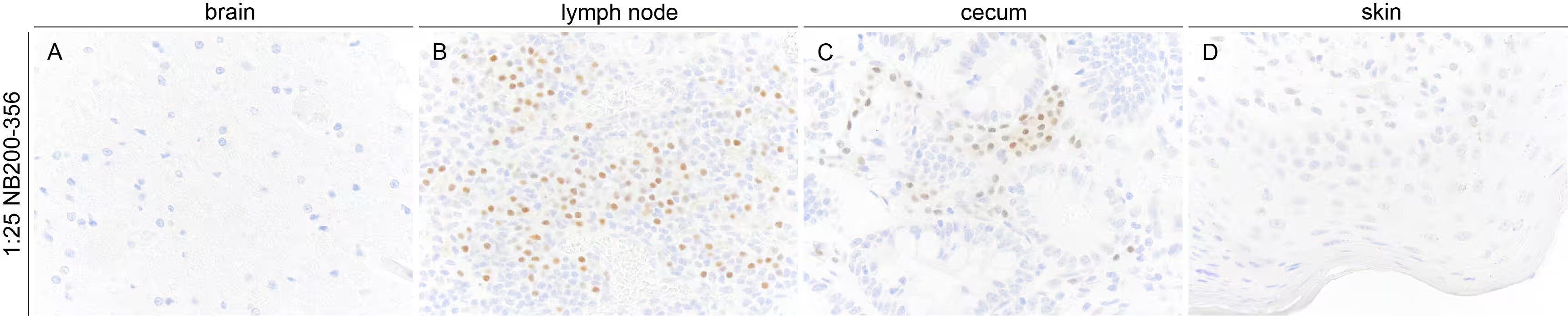 MUM1 Antibody (MUM1p)