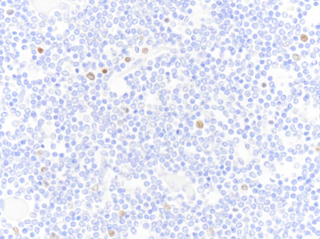 MUM1 Antibody (MUM1p)