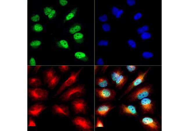 Histone H3 [p Ser10, ac Lys9] Antibody Immunocytochemistry/Immunofluorescence analysis of Histone H3 [ac Lys9/phospho Ser10] Antibody