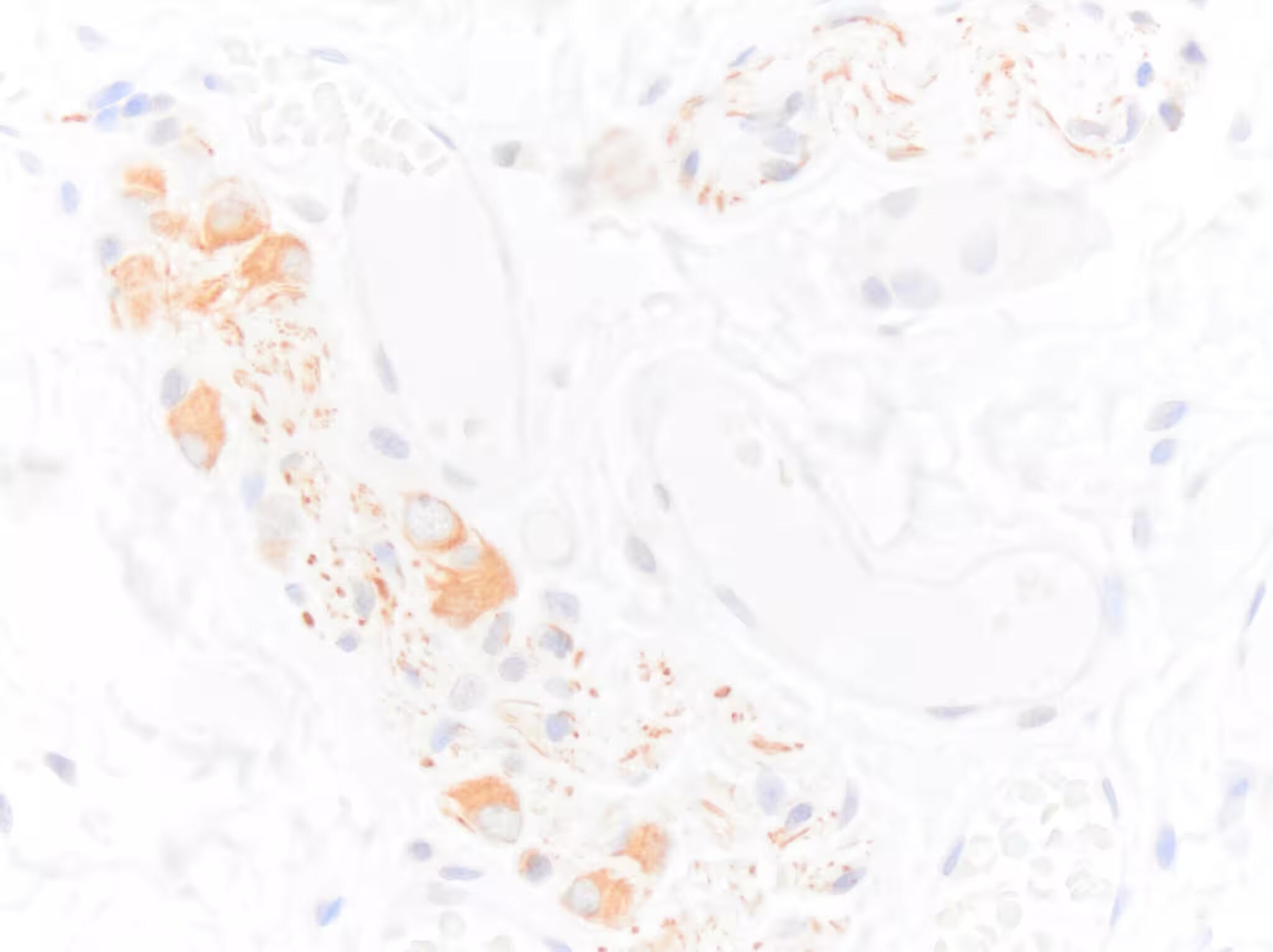 NF-H Antibody