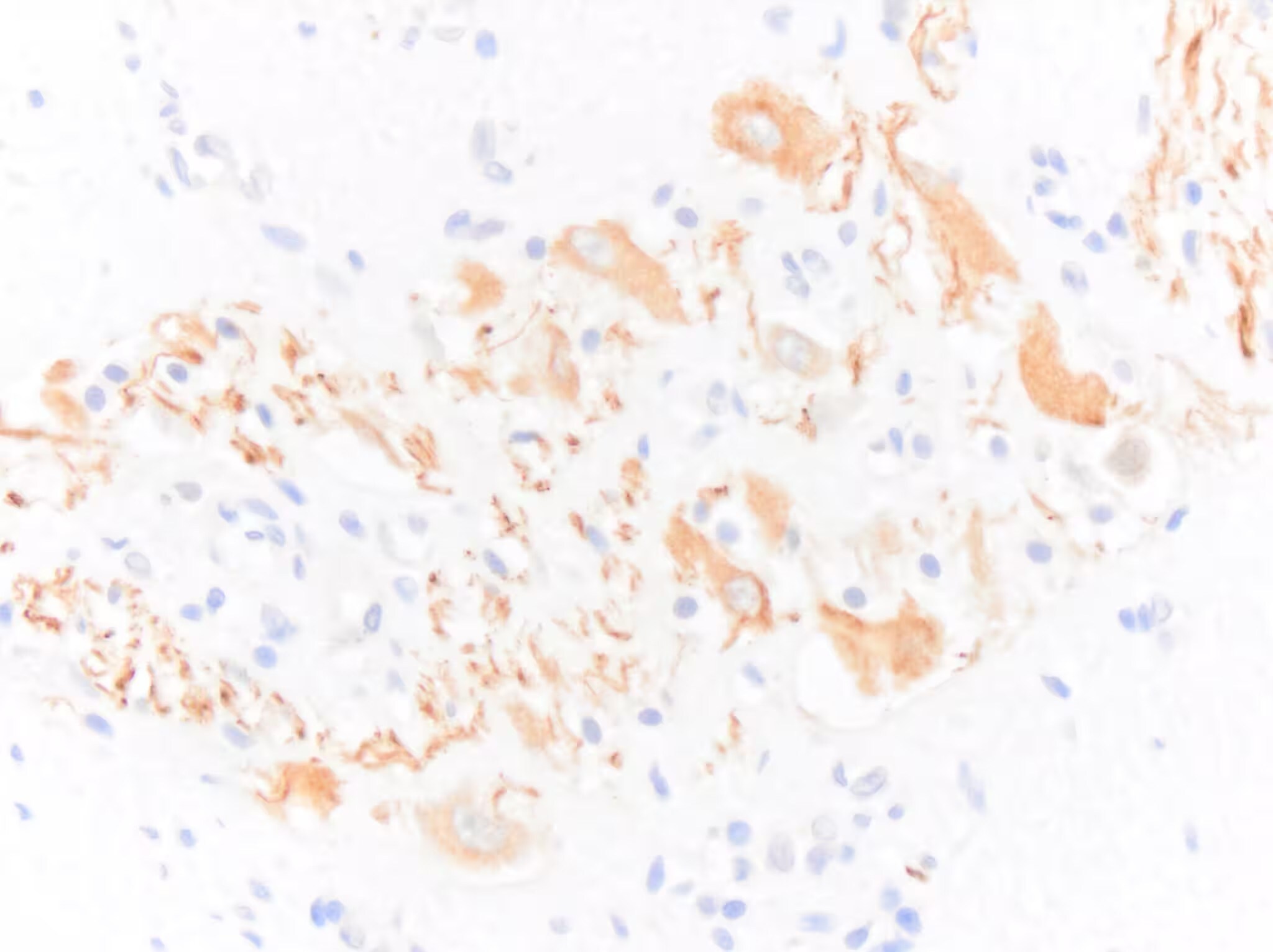 NF-H Antibody